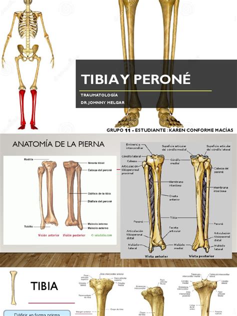 Fracturas De Tibia Y Peroné Rodilla Traumatologia