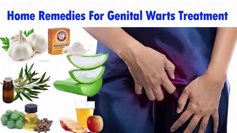 8 best home remedies for genital warts home remedies