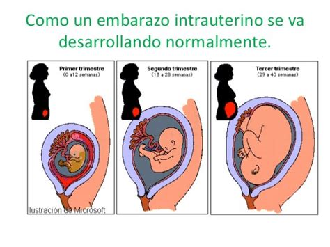 Embarazo Intrauterino