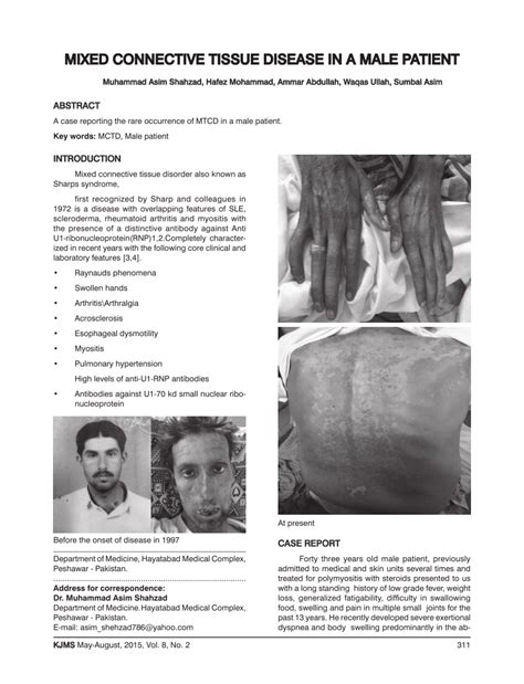 Pdf Mixed Connective Tissue Disease In A Male Patient