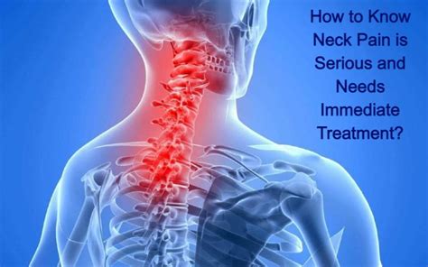 How To Know Neck Pain Is Serious And Needs Immediate Treatment