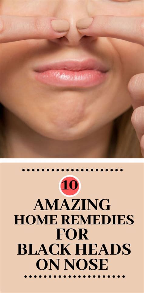 Famous How To Hide A Cold Sore Under Nose References Pressly