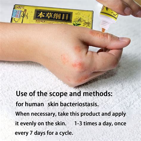 Buy 5pcs Natural Chinese Herbal Eczema Psoriasis Creams Dermatitis And