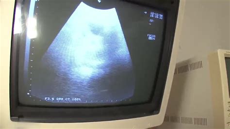 Ultrasound While Having Sex Scene From Jav
