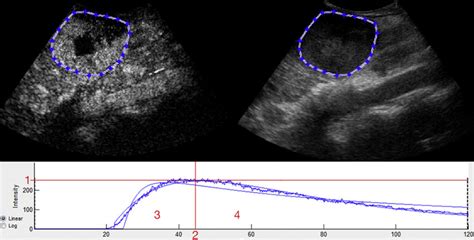 Dynamic Contrast Enhanced Ultrasound With Bolus Method And