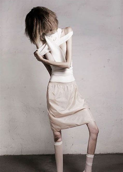 Anorexic Models Don’t Always Look Like Models ‹ Page 2 Of 2