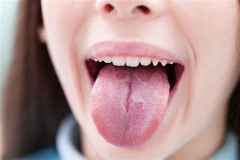 7 Things Your Tongue Says About Your Health Facty Health