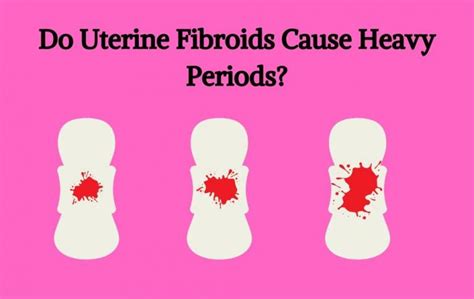 Causes Of Irregular Periods Do Fibroids Cause Heavy Bleeding