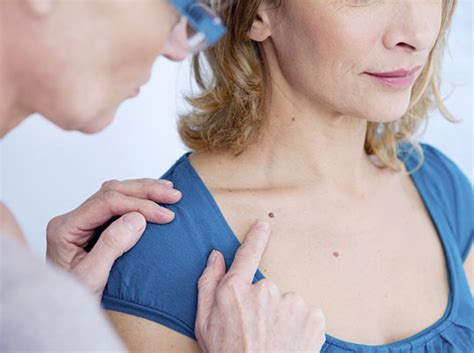 Skin Cancer Screening What To Expect Skin Associates Of South Florida