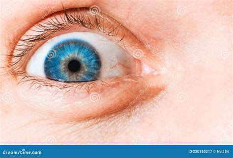 Close Up Of Wide Open Human Eye Blue Iris Vessels And Capillaries
