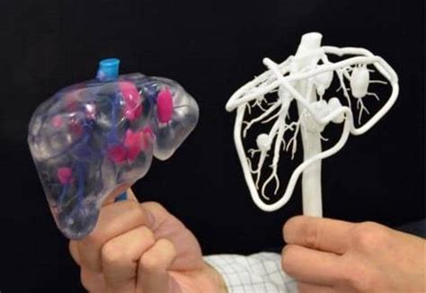 3d Printed Organs Prepare Surgeons And Could Replace Real Or