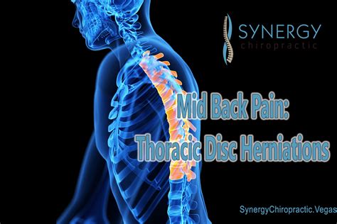 Mid Back Pain Thoracic Disc Herniations Synergy Sport And Spine