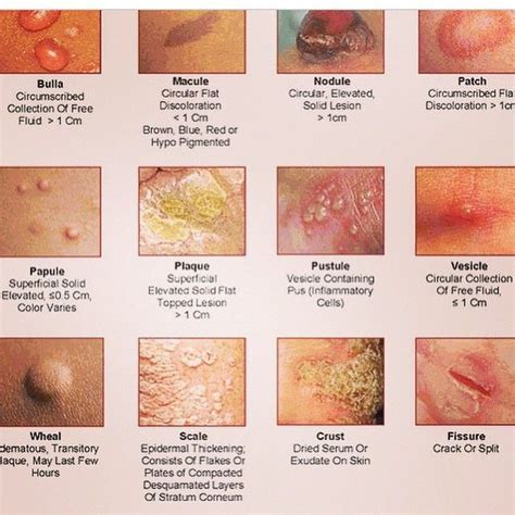 terms to use to describe skin assessment