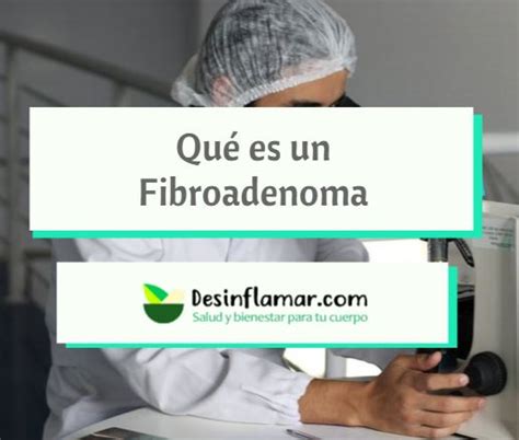 Qué es un Fibroadenoma Causas Síntomas y Tratamientos Desinflamar