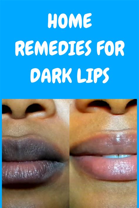how to get rid of black lips home remedies for dark lips dark lips remedies for dark lips