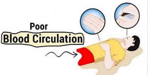 10 Warning Signs Of Poor Blood Circulation Homeremedies