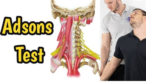 Adsons Test Thoracic Outlet Syndrome Tos Youtube