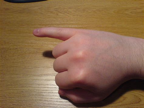 Filelittle Finger Of Right Hand Extended Wikipedia