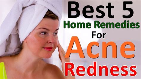 How To Get Rid Of Acne Redness Fast Acne Redness Acne Inflammation