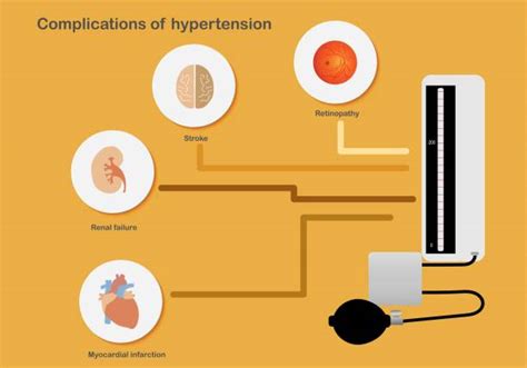 Hypertension And Ckd Ph
