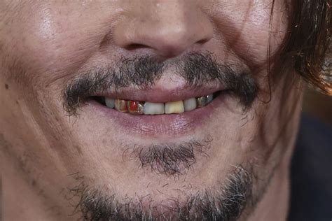 Before And After Pics Of Johnny Depps Teeth Show He Is Proud Of His