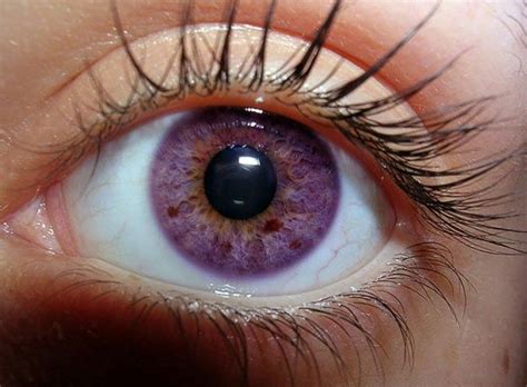 Rarest And Unusual Eye Colors That Looks Unreal Violet Eyes Eye