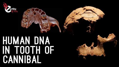 Worlds Oldest Human Dna Traced In Tooth Of Cannibal Youtube