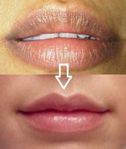 Berikut cara memerahkan bibir yang hitam dalam waktu seminggu yang patut dicoba. Cara Mengatasinya Bibir Hitam Dan Kering | Mazaya Skin Care