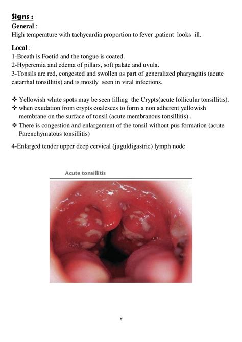 Acute Tonsillitis