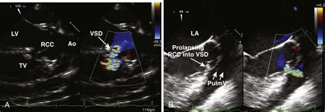 Congenital Heart Disease Clinical Gate