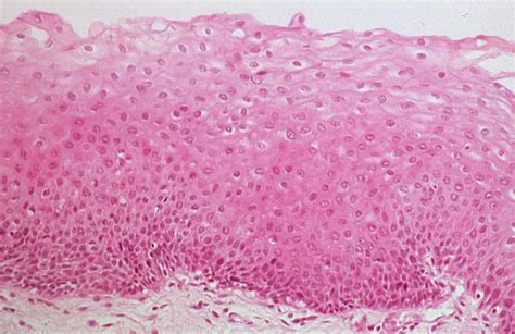 Basic Histology Stratified Squamous Epithelium Mucosa