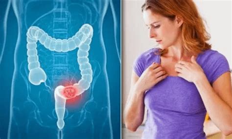 6 Early Warning Signs Of Rectal Cancer That Everyone Is Too Embarrassed