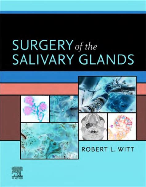 Solution 2021 Surgery Of The Salivary Glands Studypool