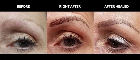 Permanent Makeup Before And After Annapolis Plastic Surgery