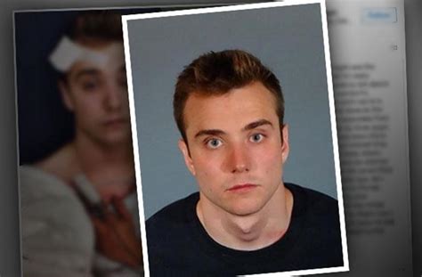 Lgbt Youtube Star May Have Faked Hate Crime Police Say