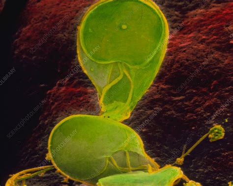 Coloured Sem Of Giardia Lamblia In Human Intestine Stock Image Z