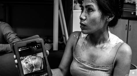 Filipina Maid Shows A Picture Is Worth A Thousand Words Cancer Incytes