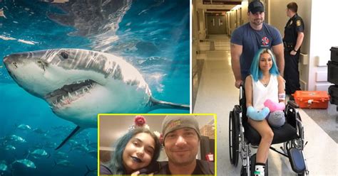 Shark Attack North Carolina Brave Dad Punches Shark Who Bit Daughter