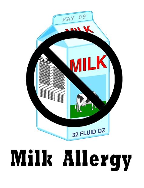Free Posters And Signs Milk Allergy