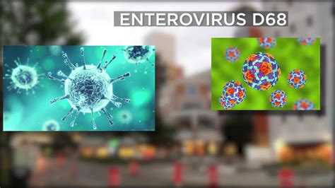 Enterovirus Cases Rising In Children Across The Twin Cities