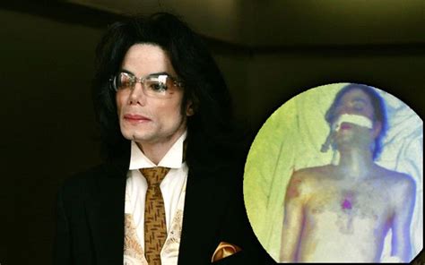 Michael Jackson Autopsy Report