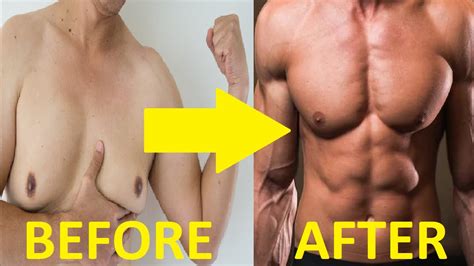 how to get rid of gynecomastia male youtube