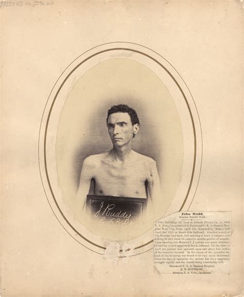 Eerie Vintage Portraits Of Wounded Soldiers During The
