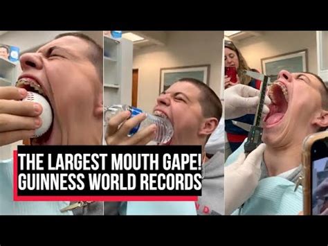 The Guinness World Record For The Widest Gaping Mouth The Largest