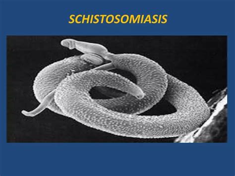 Ppt Schistosomiasis Powerpoint Presentation Free Download Id2001110