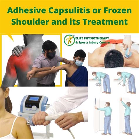 Adhesive Capsulitis Or Frozen Shoulder And Its Treatment Elite