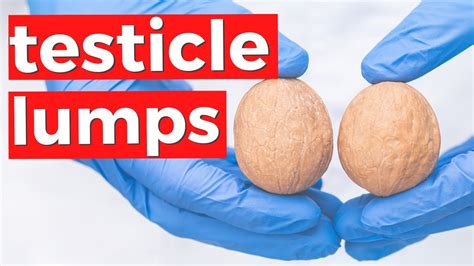 Testicular Cancer Why You Should Check Your Testicles For Lumps Youtube