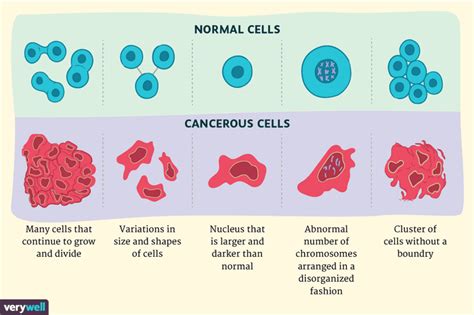 Cellules Cancéreuses Contre Cellules Normales En Quoi Sont Elles