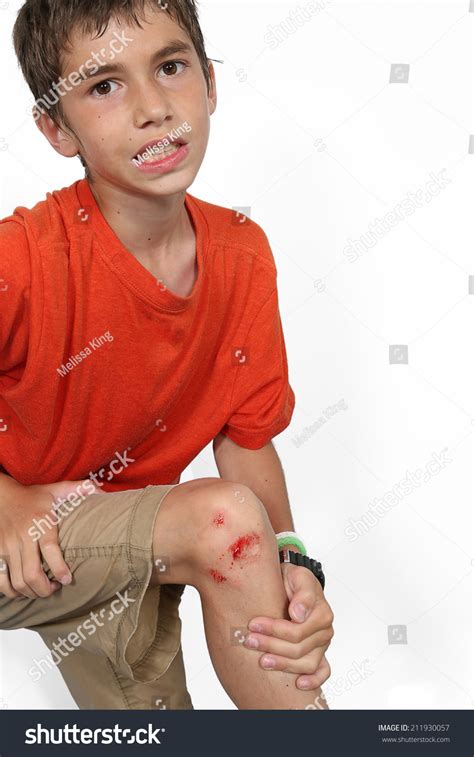 Young Boy Cut On His Leg Stock Photo 211930057 Shutterstock