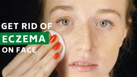 5 Best Ways To Deal With Eczema On Face Youtube